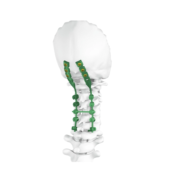 Posterior Occipitocervical Spine Screw System