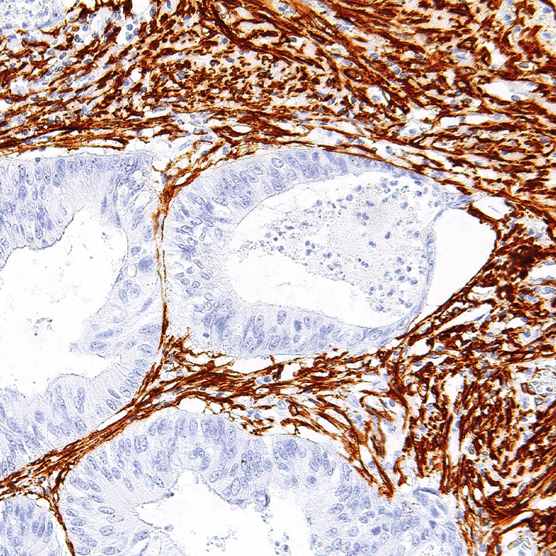 Actin (Smooth Muscle) Antibody Reagent for Immunohistochemistry