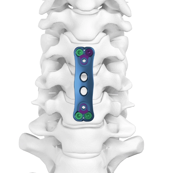 Anterior Cervical Spine Plate Ⅰ