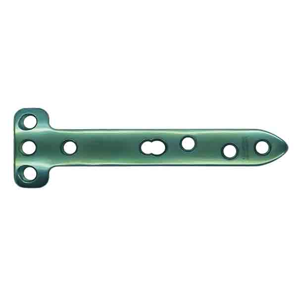 Proximal Medial Tibial Osteotomy Locking Plate